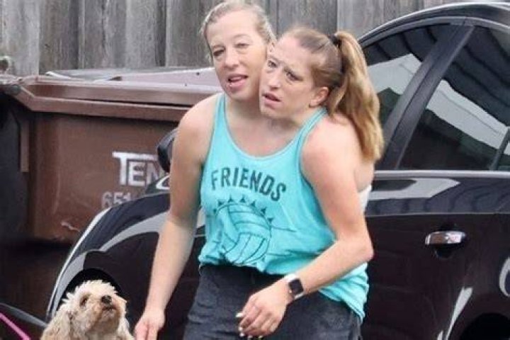 Abby & Brittany Hensel: Still Thriving Despite Unlikely Odds