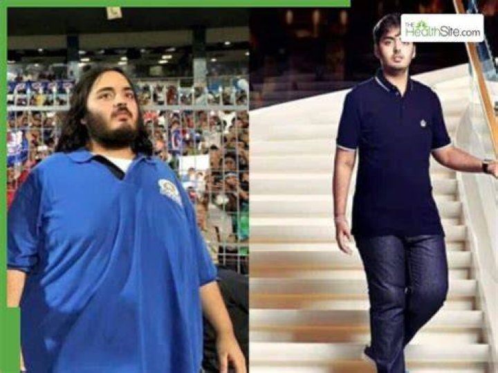 Anant Ambani's Health Journey: A Comprehensive Overview