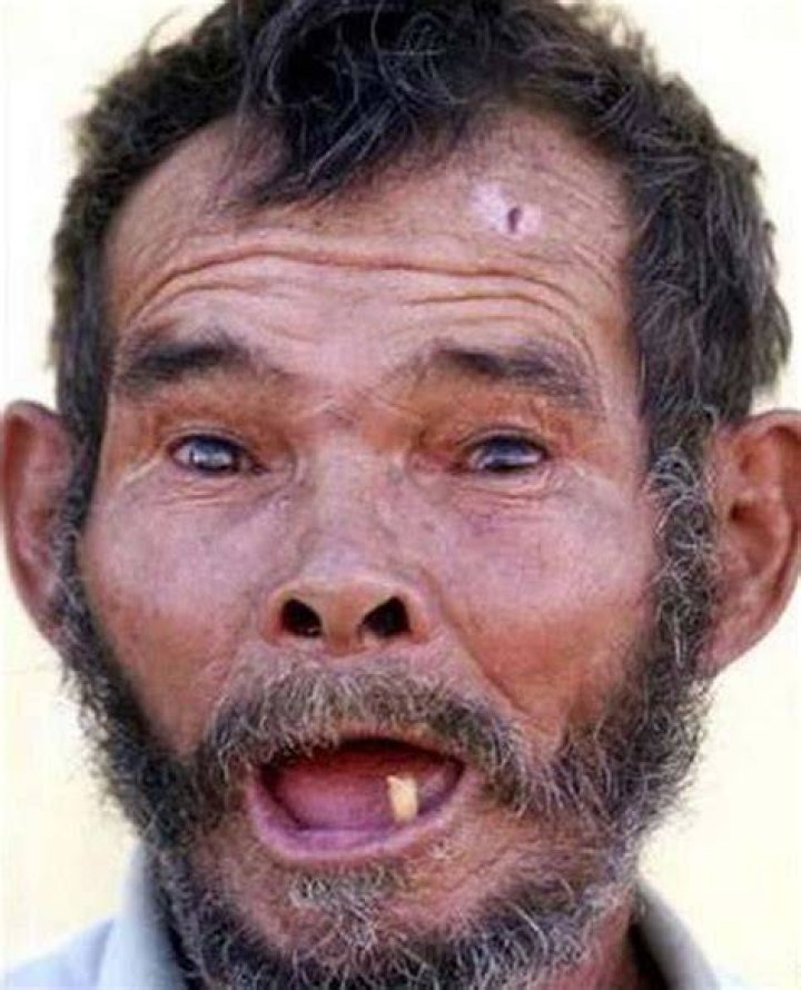Discoveries And Insights About The "Most Ugliest Man On Earth"