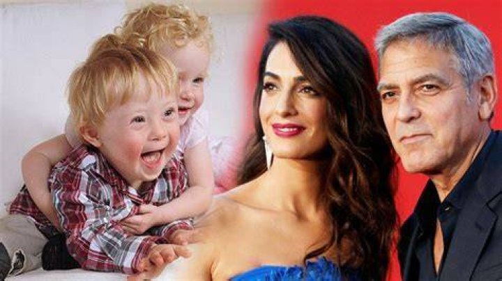 Does Clooney Have A Child With Down Syndrome? Uncovering The Truth