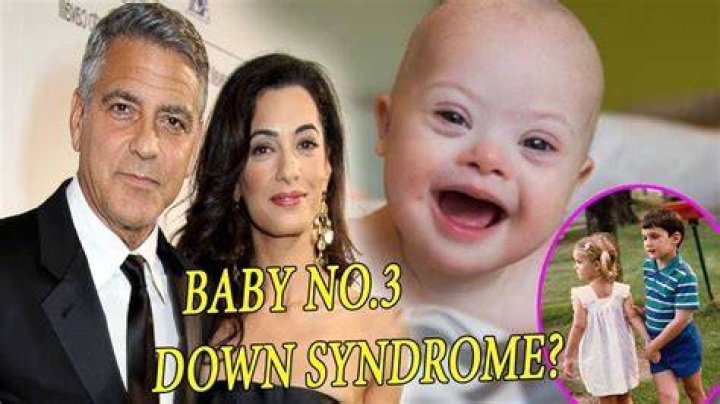 George Clooney's Twins: Raising Awareness For Down Syndrome