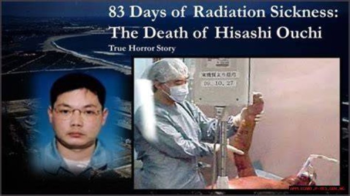 Hisashi Ouchi's Body: A Detailed Case Study