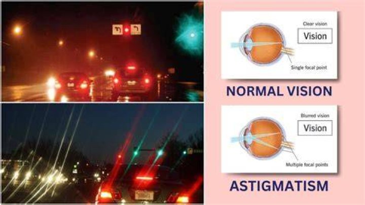 If You Have Astigmatism, This Is What Lights Look Like Truth or Fiction?