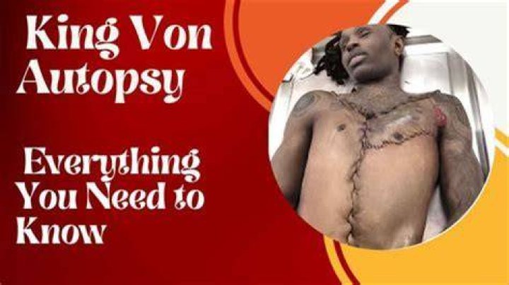 The Autopsy Of King Von: Uncovering The Tragic Details