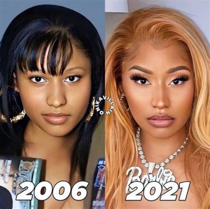 Unveiling Nicki Minaj's Skin Transformation: Secrets To Radiant Beauty