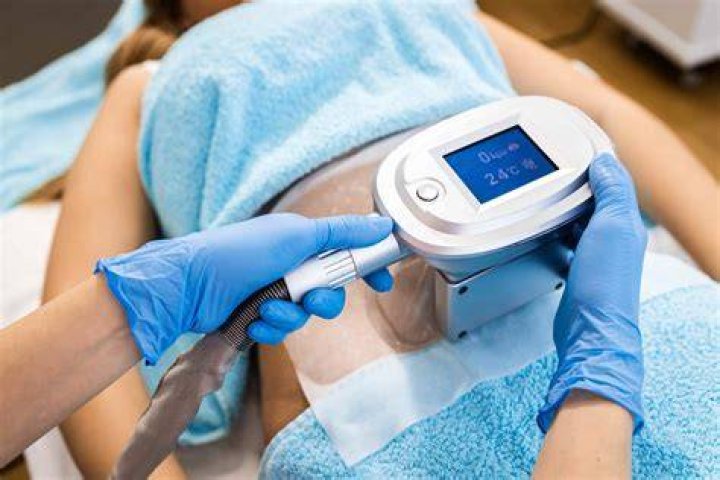 What is CoolSculpting, the procedure that Linda Evangelista says
